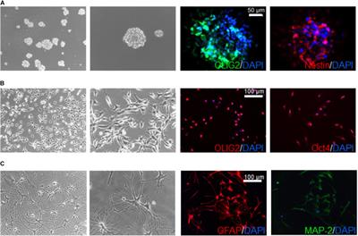 Inhibition of Chloride Intracellular Channel 1 (CLIC1) as Biguanide Class-Effect to Impair Human Glioblastoma Stem Cell Viability